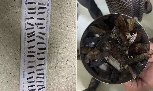 56 Pieces Of Razor Blades Found In Mans Stomach During Surgery