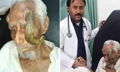 Worlds oldest man dies aged 140 after surgery