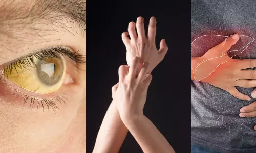 Liver Problems, health