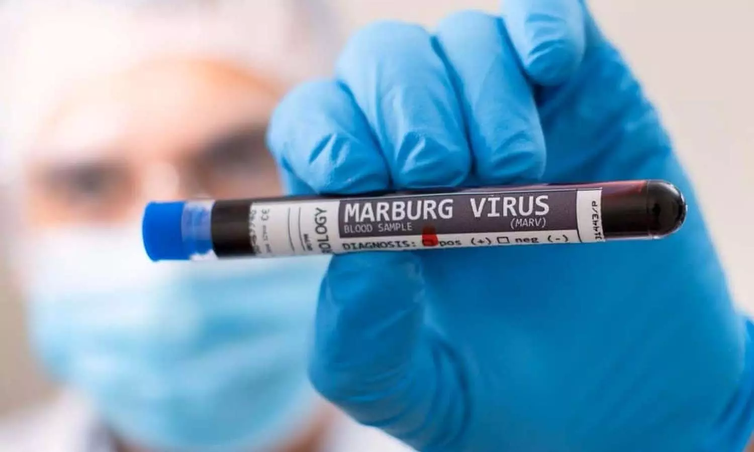 Marburg virus_saudi Marburg virus_saudi