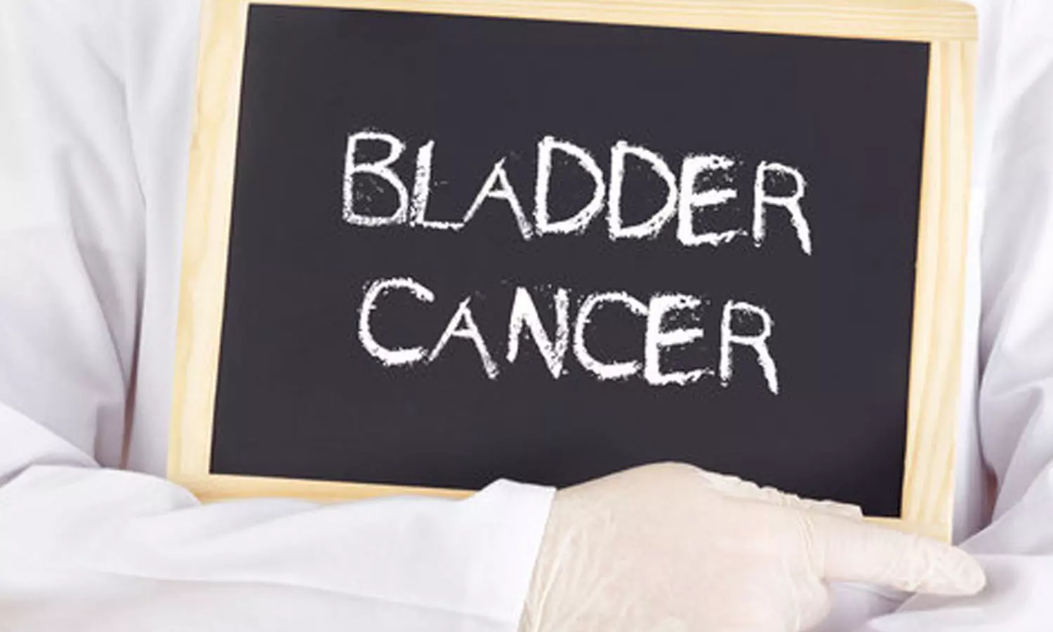 Bladder cancer symtoms and treatment