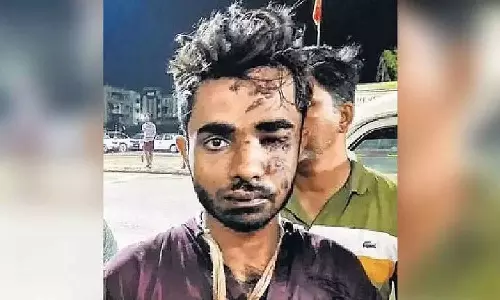 Shahrukh saifis medical examination done