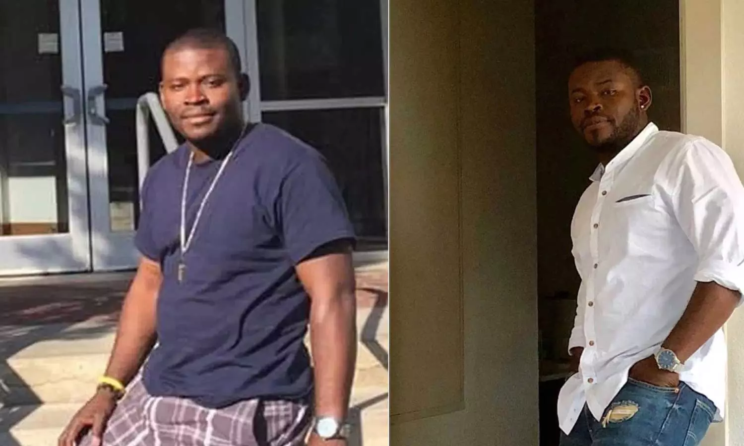 Man Spends ₹ 1.35 Crore To Grow 5 Inches Taller,world news, viral news,പൊക്കമില്ലാത്തിനാൽ പ്രണയങ്ങൾ പരാജയപ്പെടുന്നു; 1.35 കോടി രൂപ ചെലവഴിച്ച് അഞ്ച് ഇഞ്ച് നീളം കൂട്ടി യുവാവ്