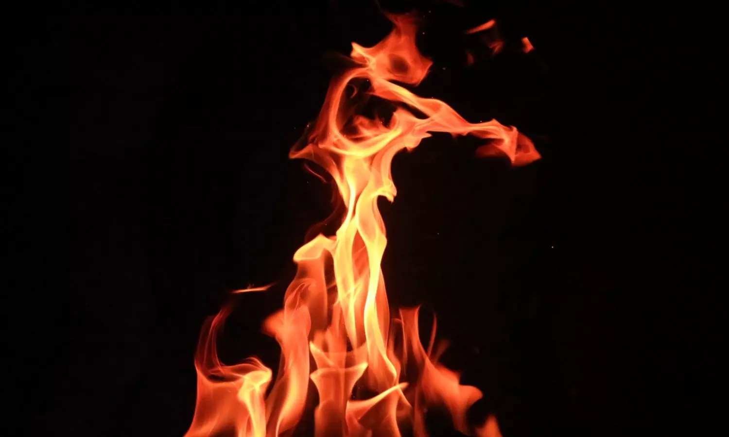 Couple suffered burns in the Ernakulam Couple suffered burns in the Ernakulam