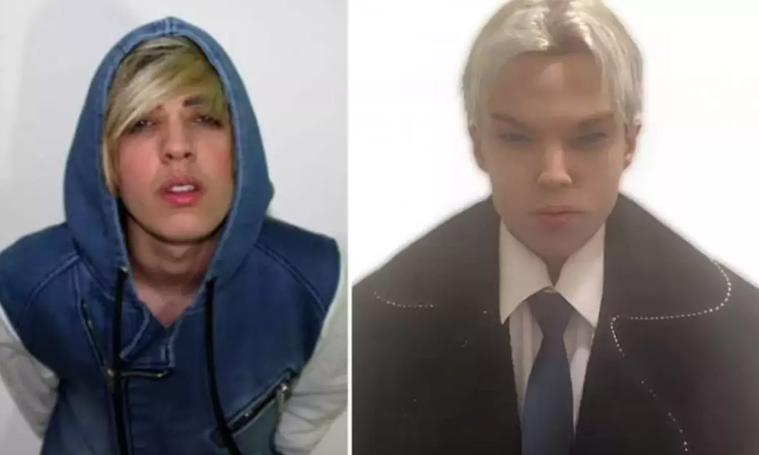 /entertainment/22-year-old-underwent-12-facial-surgeries-to-look-like-jim-finally-the-tragic-end-216009