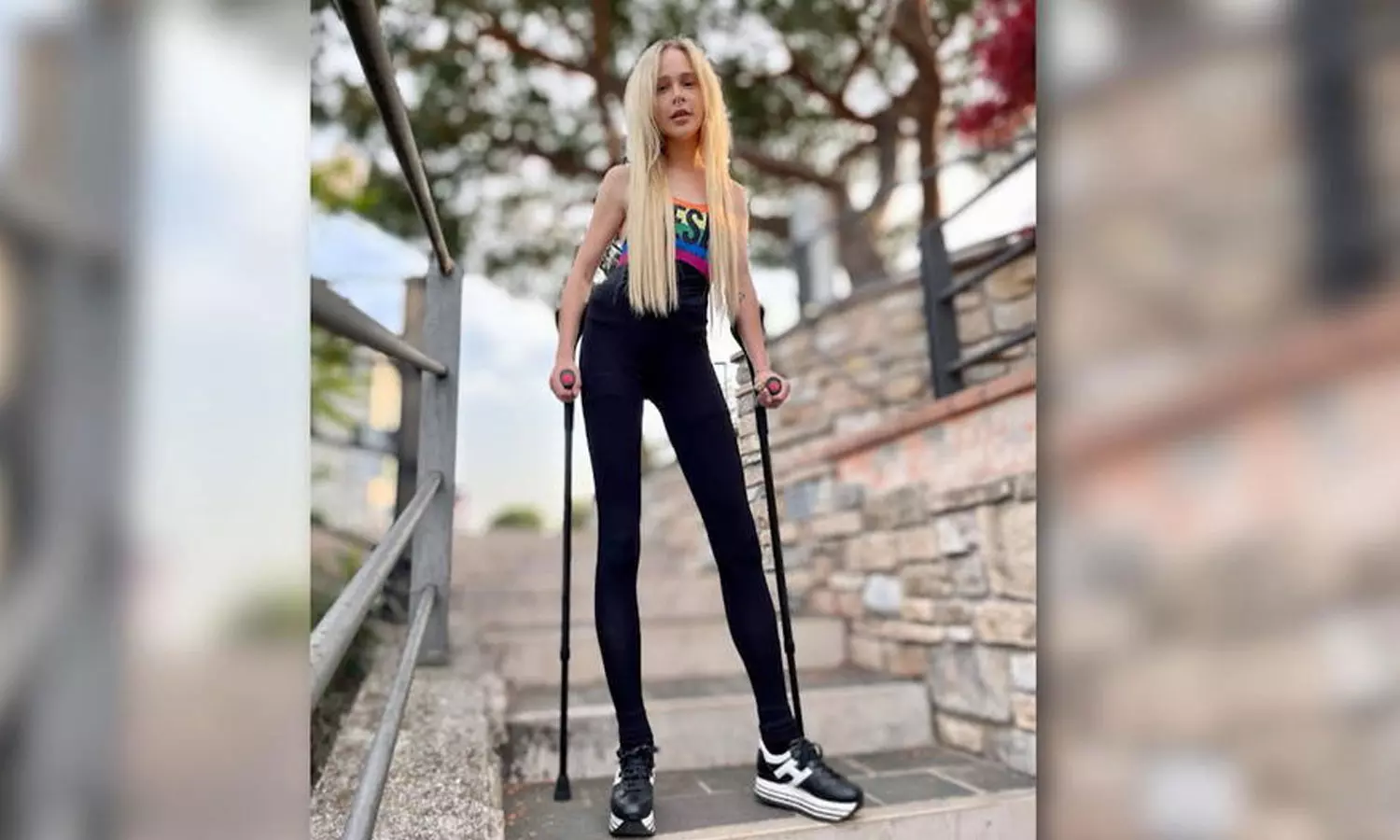 Model spent 1 crore to lengthen legs Model spent 1 crore to lengthen legs