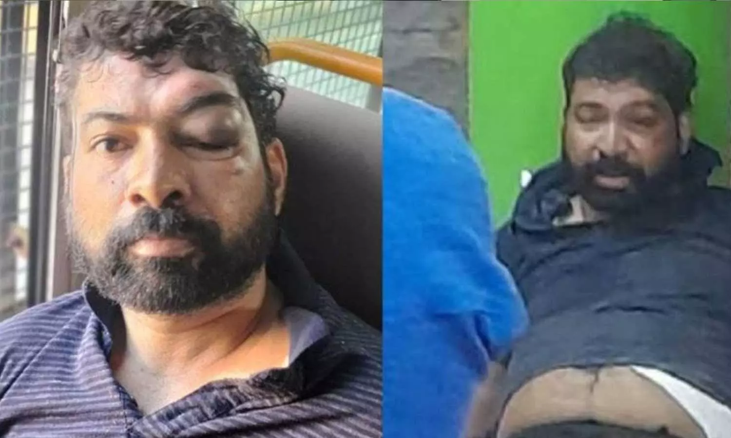 Dr. Vandana Das murder case accused Sandeep released in custody crime branch,ഡോ.വന്ദന ദാസ് കൊലക്കേസ് പ്രതി സന്ദീപിനെ ക്രൈം ബ്രാഞ്ചിന്റെ കസ്റ്റഡിയിൽ വിട്ടു,latest malayalam news Dr. Vandana Das murder case accused Sandeep released in custody crime branch,ഡോ.വന്ദന ദാസ് കൊലക്കേസ് പ്രതി സന്ദീപിനെ ക്രൈം ബ്രാഞ്ചിന്റെ കസ്റ്റഡിയിൽ വിട്ടു,latest malayalam news