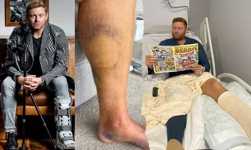 Jonny Bairstow was feared of waling after leg injury, English Cricketer Jonny Bairstow about leg injury, Jonny Bairstow leg injury Jonny Bairstow was feared of waling after leg injury, English Cricketer Jonny Bairstow about leg injury, Jonny Bairstow leg injury