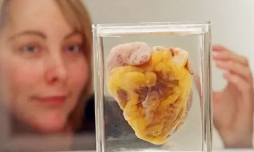 Woman Sees Her Own Heart On Display At Museum