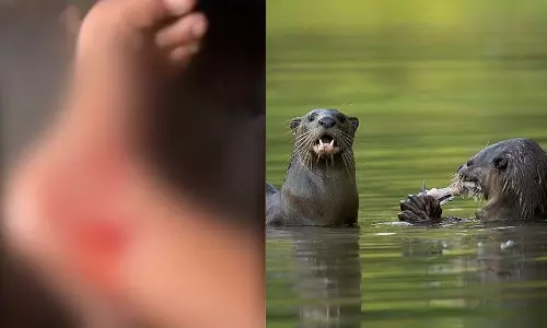 Kozhikode students were bitten by a otters, otters atatck, neer naya, latest malayalam news, കോഴിക്കോട് വിദ്യാർത്ഥികളെ നീർ നായ കടിച്ചു, നീർനായ ആക്രമണം, ഏറ്റവും പുതിയ മലയാളം വാർത്തകള്‍