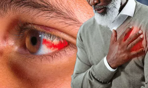 How does eyes indicate an impending heart attack
