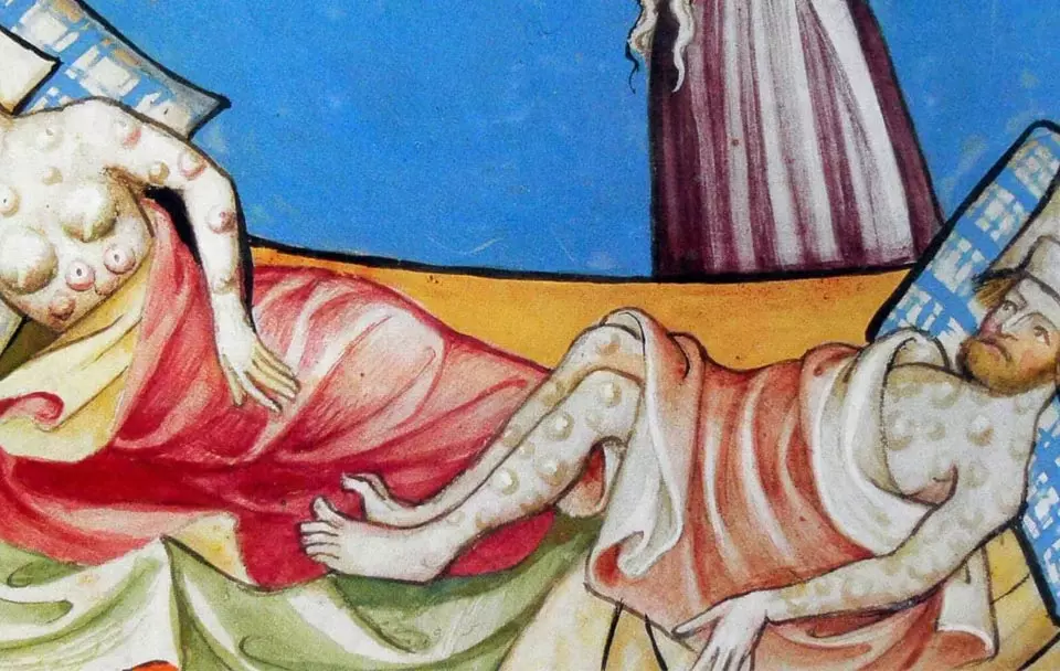 പ്‌ളേഗ് - കറുത്ത മരണം