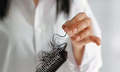 hair loss