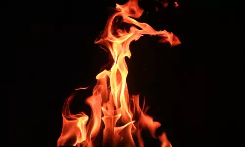 പെട്രോളടിച്ച് പുറത്തിറങ്ങിയ ഉടനെ കാറിന് തീപിടിച്ചു; ചാടിയിറങ്ങി ഡ്രൈവർ