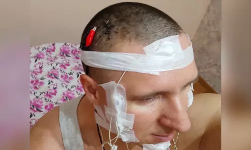 Russian Man Almost Dies After Brain Surgery At Home