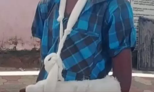 12-year-old handcuffed for taking cricket bat without permission,latest malayalam news,അനുവാദം ഇല്ലാതെ ക്രിക്കറ്റ് ബാറ്റ് എടുത്തതിന് 12 വയസുകാരന്‍റെ കൈയൊടിച്ചു; ബന്ധുവായ യുവാവ് പിടിയില്‍,