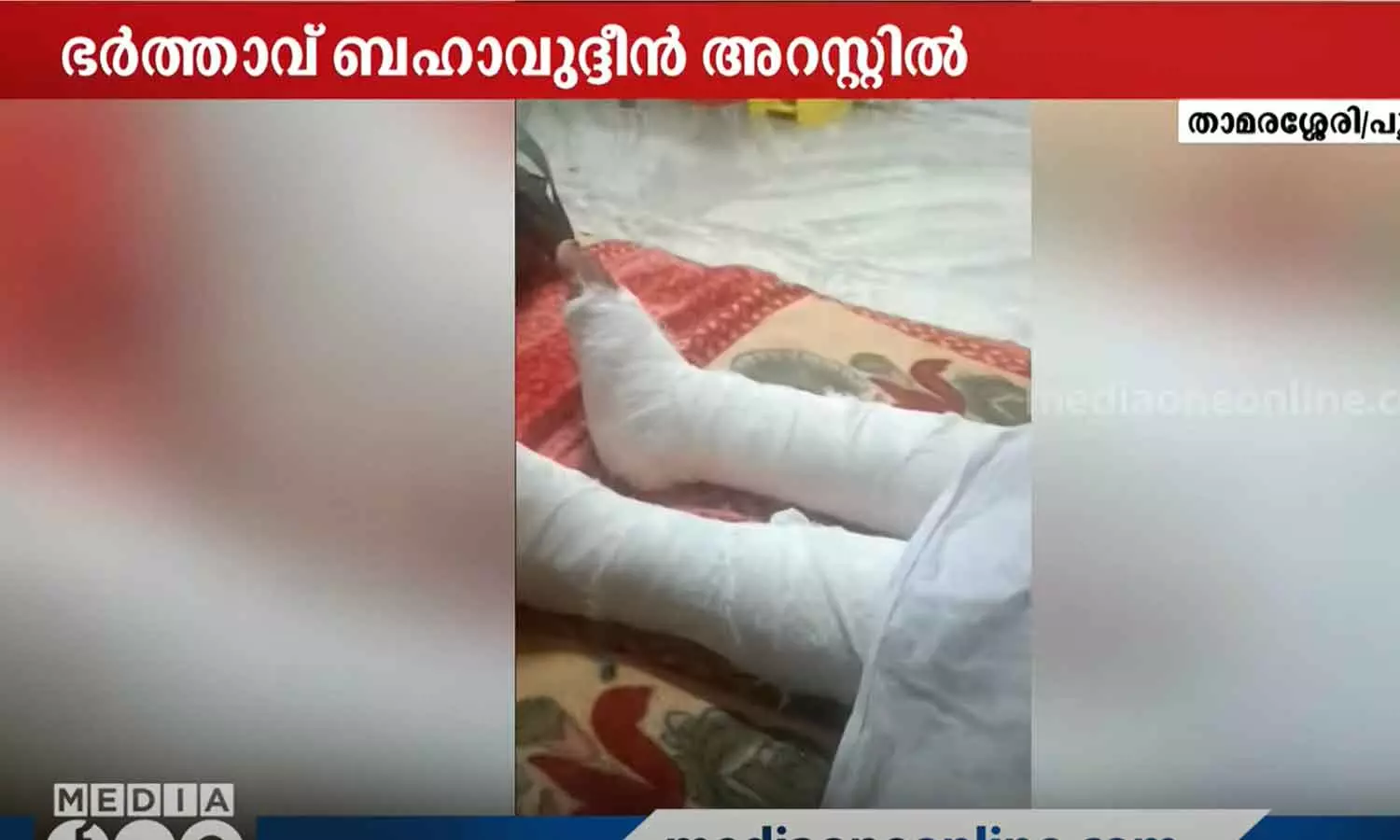 husband tortured wife kozhikode thamarassery