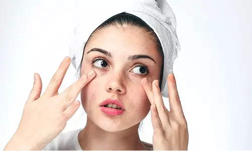 ഓയിലിയോ ഡ്രൈയോ? ഏതാണ് നിങ്ങളുടെ ചർമ്മം? കണ്ടെത്താൻ എളുപ്പവഴികൾ