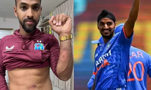 നന്ദിയുണ്ട്; അർഷ്ദീപ്, ബ്രാൻഡൻ കിങ്..  ഈ പരിക്കിന്: ചിത്രം പങ്കുവെച്ച് നിക്കോളസ് പുരാൻ