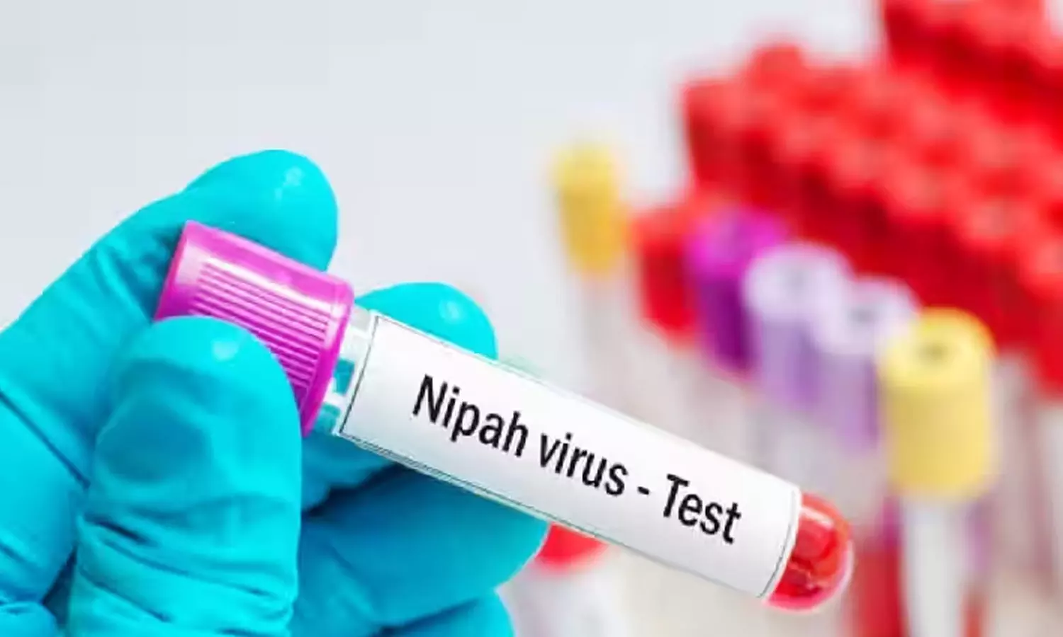 കോഴിക്കോട് അസ്വാഭാവിക പനി മരണം; നിപയെന്ന് സംശയം, ജില്ലയില് അതീവ ജാഗ്രതാ നിർദേശം കോഴിക്കോട് അസ്വാഭാവിക പനി മരണം; നിപയെന്ന് സംശയം, ജില്ലയില് അതീവ ജാഗ്രതാ നിർദേശം