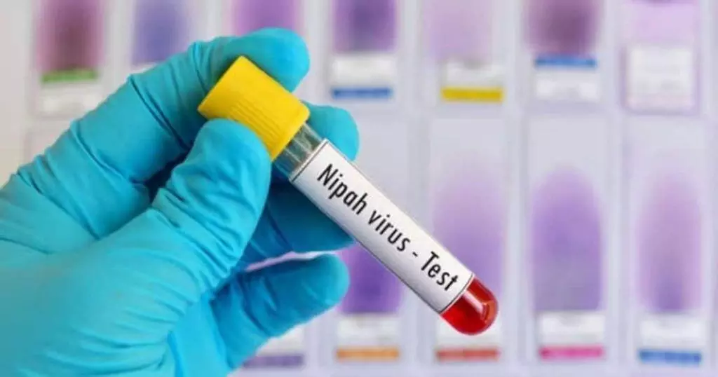 Nipah Test