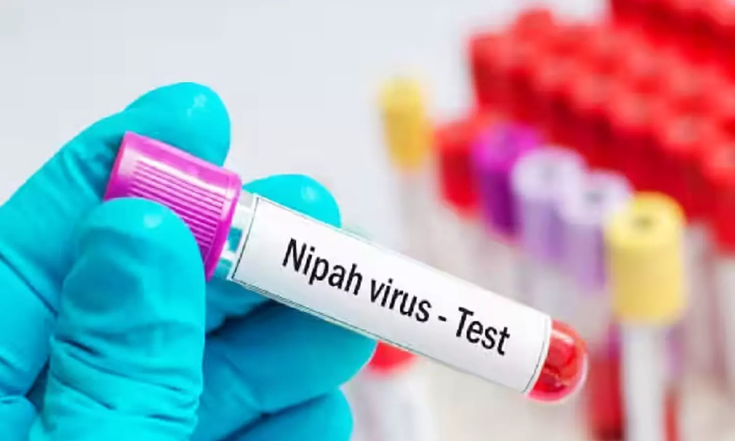nipah virus