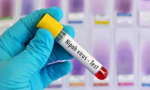 Nipah Test Nipah Test