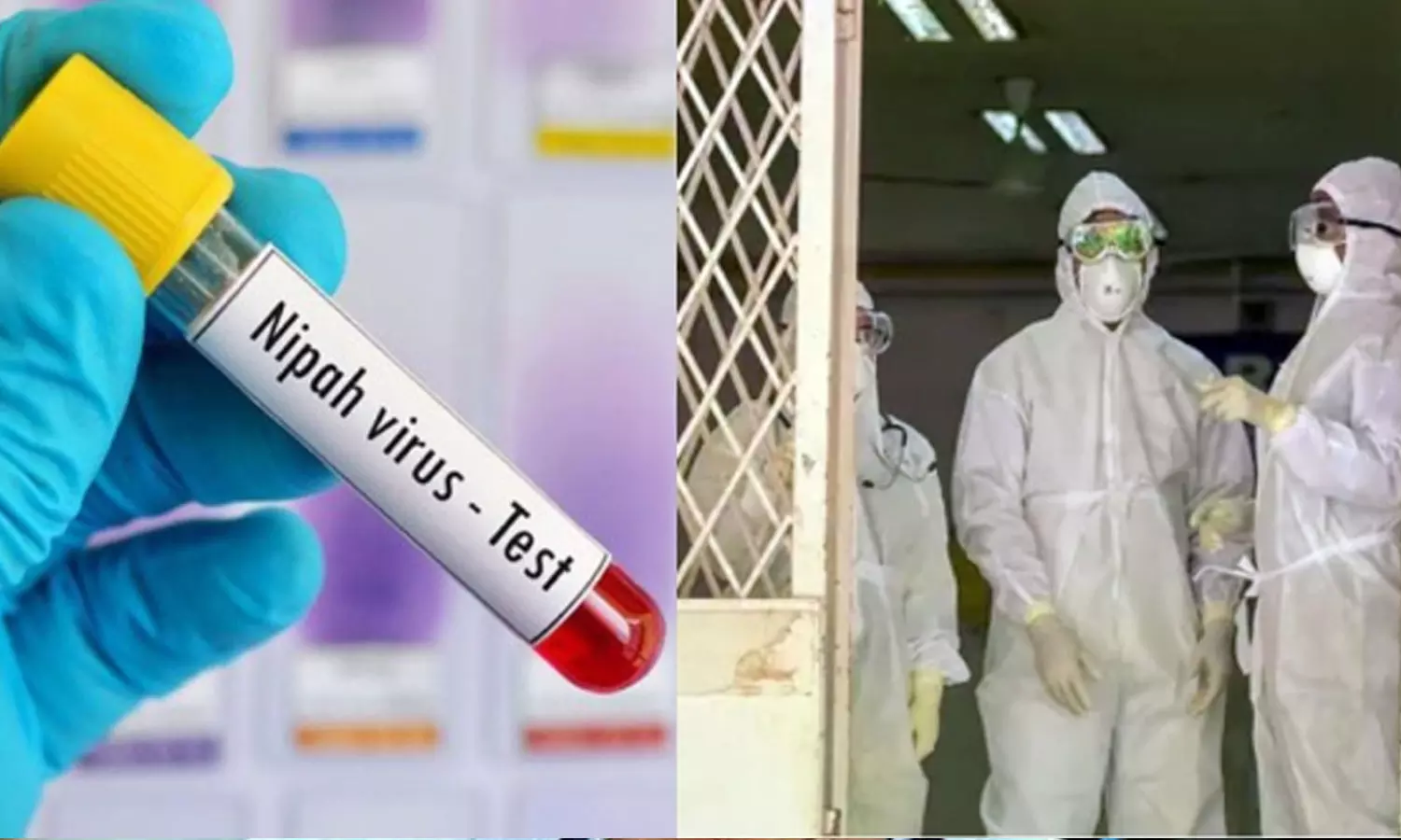 നിപ: മൂന്ന് കേന്ദ്ര സംഘങ്ങൾ ഇന്ന് കോഴിക്കോട്ടെത്തും; രണ്ടു ആരോഗ്യപ്രവർത്തകരുടെ സാമ്പിളുകൾ കൂടി പരിശോധനക്കയച്ചു നിപ: മൂന്ന് കേന്ദ്ര സംഘങ്ങൾ ഇന്ന് കോഴിക്കോട്ടെത്തും; രണ്ടു ആരോഗ്യപ്രവർത്തകരുടെ സാമ്പിളുകൾ കൂടി പരിശോധനക്കയച്ചു