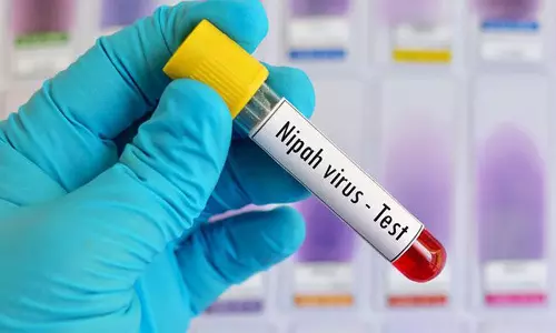 നിപയിൽ ആശ്വാസം; 11 പേരുടെ പരിശോധനാ ഫലം നെഗറ്റീവ് നിപയിൽ ആശ്വാസം; 11 പേരുടെ പരിശോധനാ ഫലം നെഗറ്റീവ്