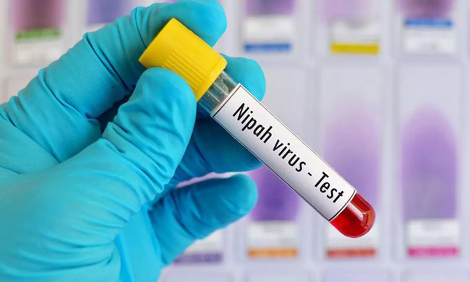 nipah virus nipah virus