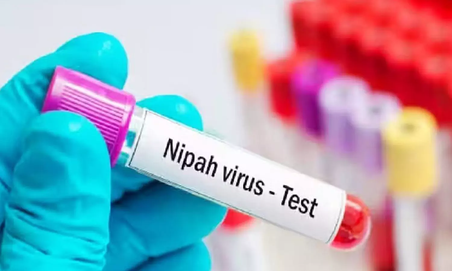 നിപ: മലപ്പുറത്ത് നിന്ന് അയച്ച നിപ സാമ്പിൾ ഫലം നെഗറ്റീവ് നിപ: മലപ്പുറത്ത് നിന്ന് അയച്ച നിപ സാമ്പിൾ ഫലം നെഗറ്റീവ്