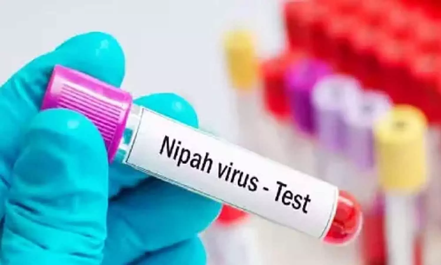 ആദ്യം മരിച്ചയാൾക്കും നിപ; ആഗസ്റ്റ് 30ന് മരിച്ചയാളുടെ സാമ്പിൾ പരിശോധനാ ഫലമാണ് പോസിറ്റീവായത് ആദ്യം മരിച്ചയാൾക്കും നിപ; ആഗസ്റ്റ് 30ന് മരിച്ചയാളുടെ സാമ്പിൾ പരിശോധനാ ഫലമാണ് പോസിറ്റീവായത്