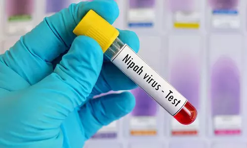 nipah virus