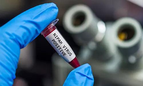 Nipah suspected again in Thiruvananthapuram, two samples will be sent for testing, nipah in calicut, latest malayalam news, തിരുവനന്തപുരത്ത് നിപ്പ വീണ്ടും സംശയം, രണ്ട് സാമ്പിളുകൾ പരിശോധനയ്ക്ക് അയക്കും, കോഴിക്കോട് നിപ്പ, ഏറ്റവും പുതിയ മലയാളം വാർത്ത Nipah suspected again in Thiruvananthapuram, two samples will be sent for testing, nipah in calicut, latest malayalam news, തിരുവനന്തപുരത്ത് നിപ്പ വീണ്ടും സംശയം, രണ്ട് സാമ്പിളുകൾ പരിശോധനയ്ക്ക് അയക്കും, കോഴിക്കോട് നിപ്പ, ഏറ്റവും പുതിയ മലയാളം വാർത്ത