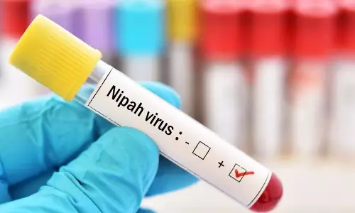 Nipa resistance, A special committee to coordinate the activities of the Forest Department, Forest Department, nipah in calicut, നിപ പ്രതിരോധം, വനം വകുപ്പിന്റെ പ്രവർത്തനങ്ങൾ ഏകോപിപ്പിക്കാൻ പ്രത്യേക സമിതി, വനം വകുപ്പ്, കോഴിക്കോട് നിപ, Nipa resistance, A special committee to coordinate the activities of the Forest Department, Forest Department, nipah in calicut, നിപ പ്രതിരോധം, വനം വകുപ്പിന്റെ പ്രവർത്തനങ്ങൾ ഏകോപിപ്പിക്കാൻ പ്രത്യേക സമിതി, വനം വകുപ്പ്, കോഴിക്കോട് നിപ,