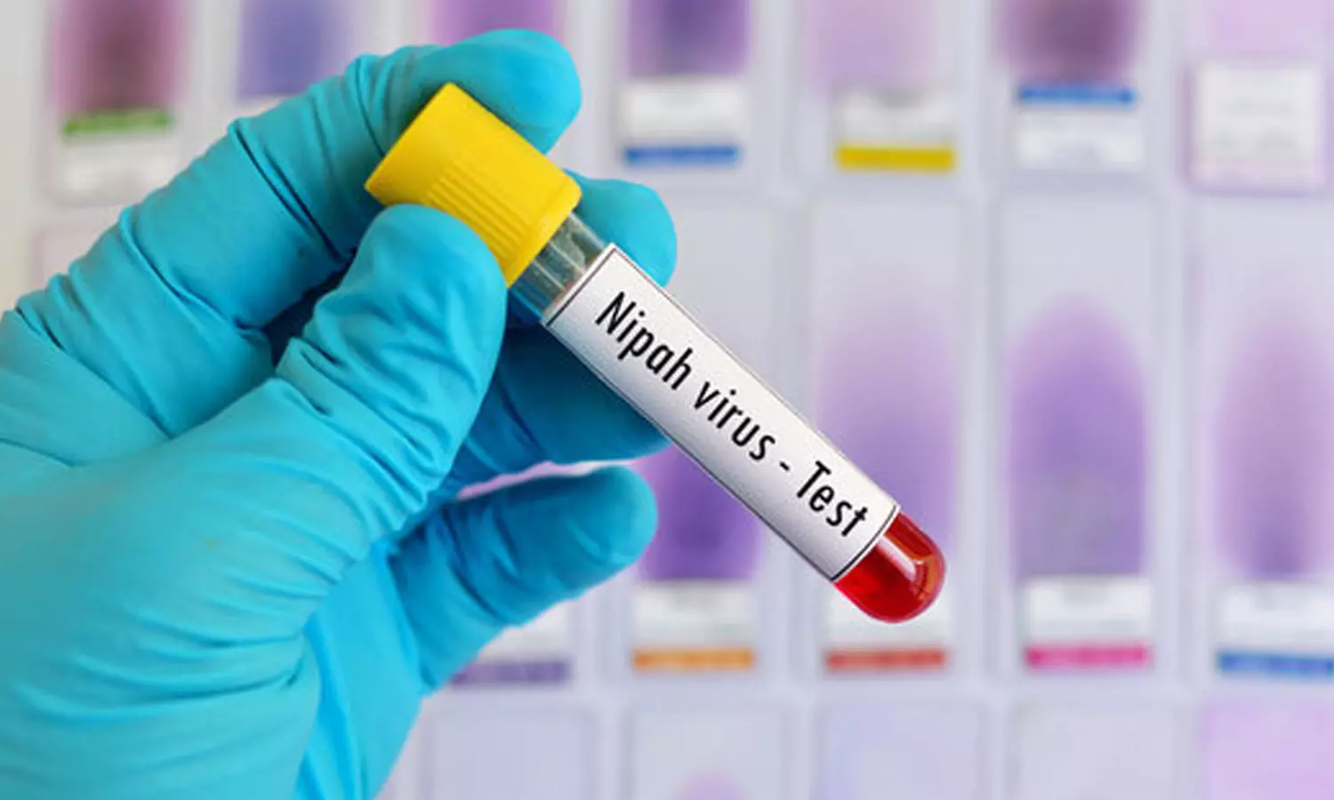 തിരുവനന്തപുരത്തെ  നിപ ഭീതി ഒഴിയുന്നു; വിദ്യാർഥിയുടെ പരിശോധനാ ഫലം നെഗറ്റീവ്