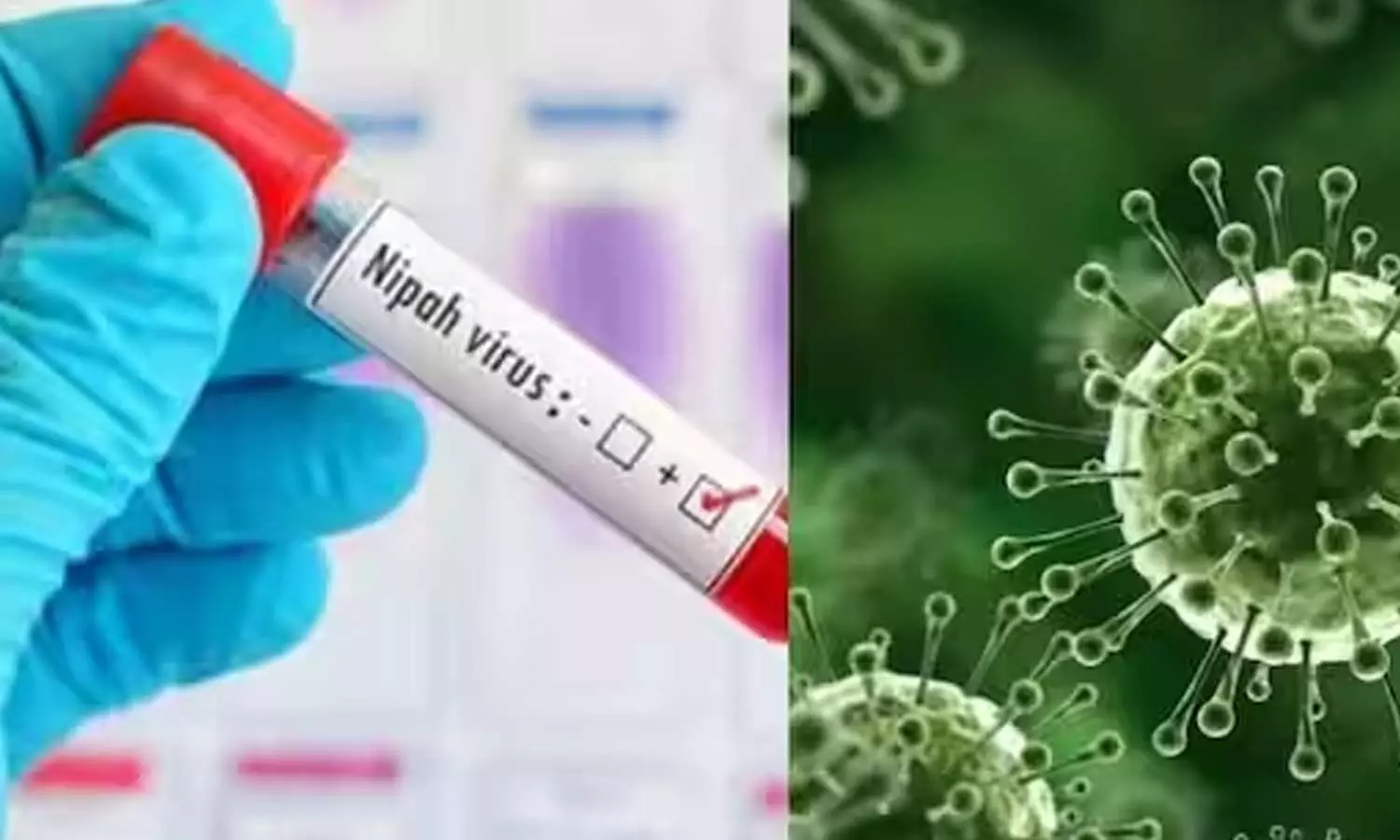 Nipah: Health department steps up vigil in calicut | kerala News Nipah: Health department steps up vigil in calicut | kerala News