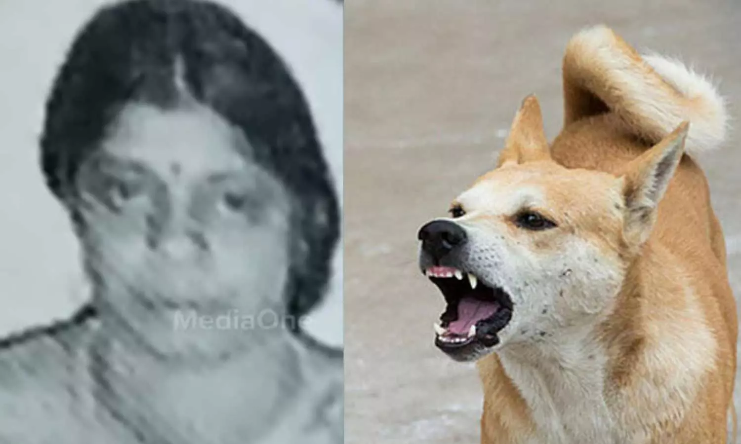 woman dies of rabies in cherpulasery | kerala News