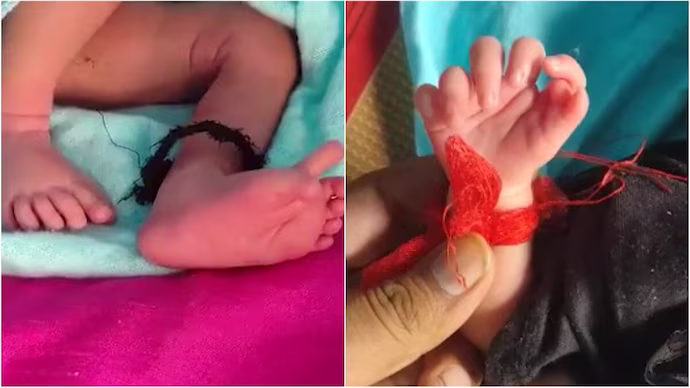 Baby born with 26 fingers