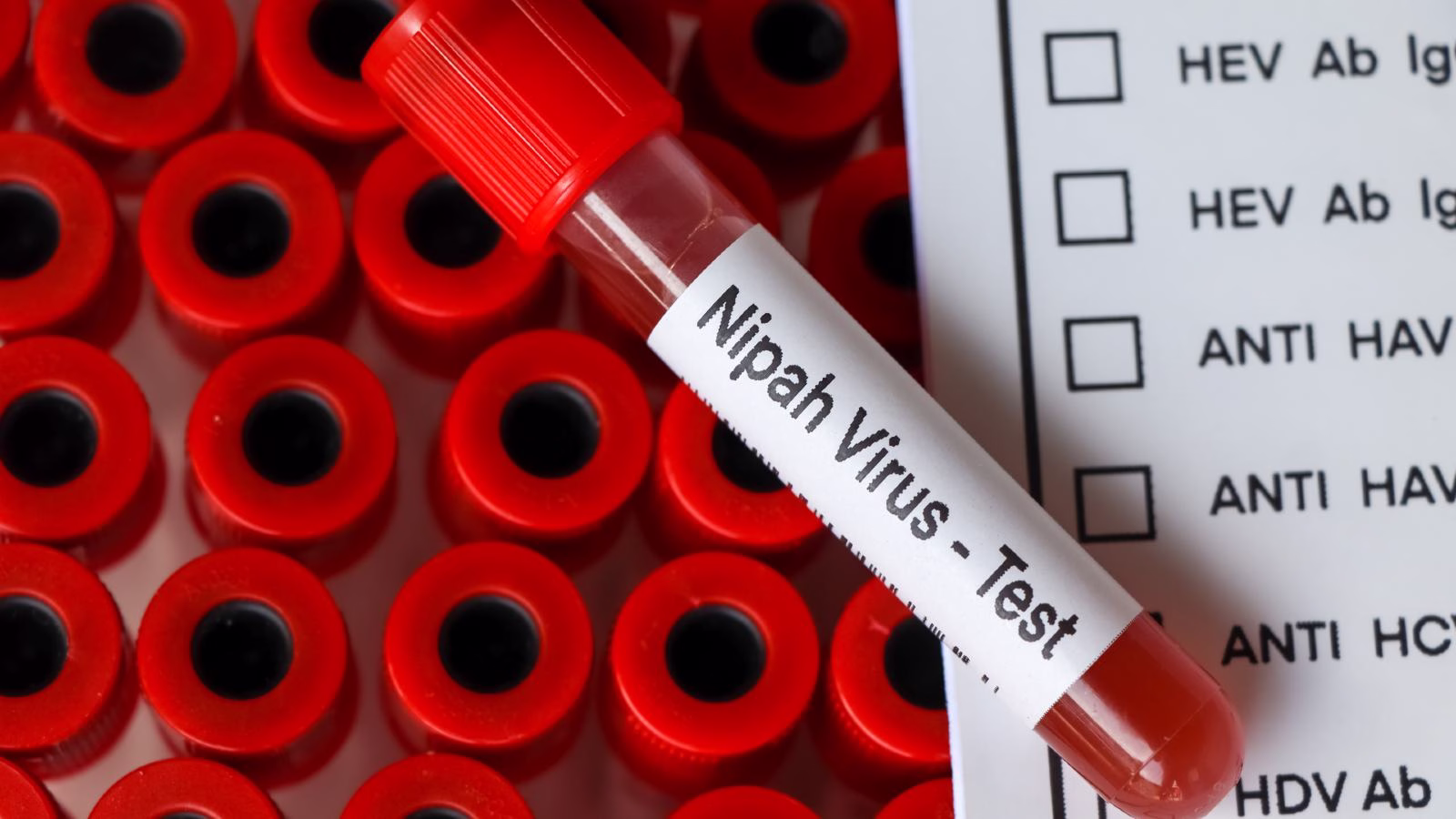 nipah virus