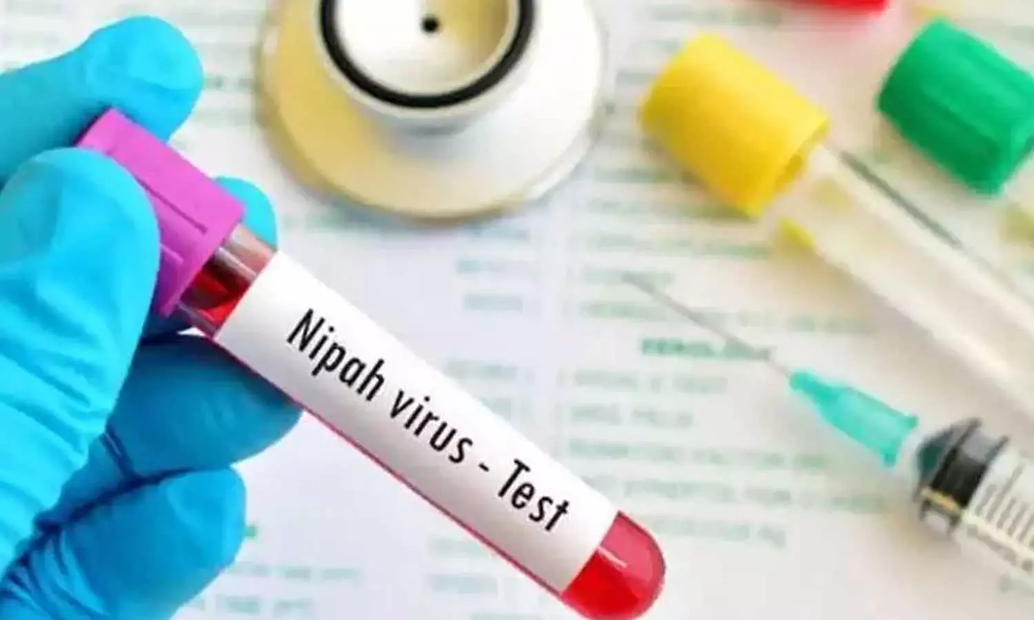 നിപ:ഇന്ന് പുതിയ പോസിറ്റീവ് കേസുകൾ ഇല്ല, ചികിത്സയിലുള്ളവരുടെ ആരോഗ്യ നില തൃപ്തികരം- വീണാ ജോർജ് നിപ:ഇന്ന് പുതിയ പോസിറ്റീവ് കേസുകൾ ഇല്ല, ചികിത്സയിലുള്ളവരുടെ ആരോഗ്യ നില തൃപ്തികരം- വീണാ ജോർജ്