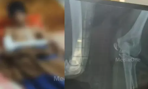 Thiruvananthapuram, beaten, classmates, school fights, latest malayalamnews, തിരുവനന്തപുരം, അടിച്ചു, സഹപാഠികൾ, സ്കൂൾ വഴക്കുകൾ, ഏറ്റവും പുതിയ മലയാളം വാർത്തകൾ