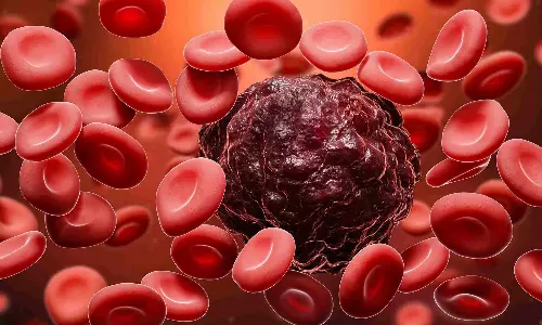 Early detection of leukemia, symptoms, symptoms of  leukemia, latest malayalam news, രക്താർബുദം നേരത്തെ കണ്ടെത്തൽ, ലക്ഷണങ്ങൾ, രക്താർബുദത്തിന്റെ ലക്ഷണങ്ങൾ, ഏറ്റവും പുതിയ മലയാളം വാർത്തകൾ