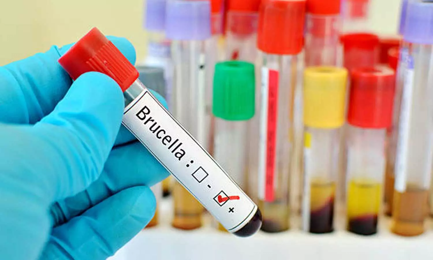 Brucellosis, a zoonotic disease, has been confirmed in Thiruvananthapuram