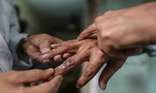 കുഷ്ഠരോഗം; ശരീരത്തിൽ നിറവ്യത്യാസമുണ്ടെങ്കിൽ ചികിത്സ തേടണം, ആശങ്ക വേണ്ടെന്ന് ആരോഗ്യവകുപ്പ്