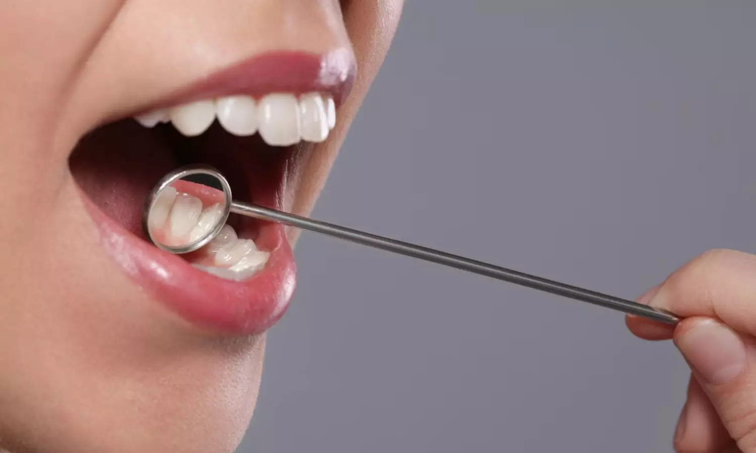 Things to know about oral cancer Things to know about oral cancer