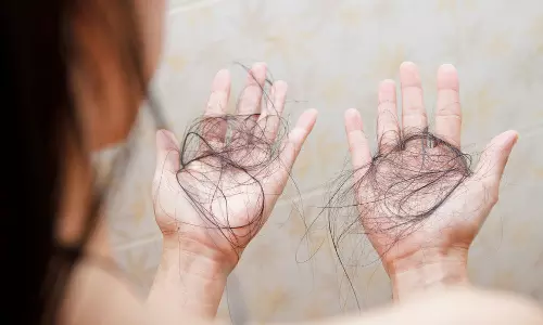 hair fall