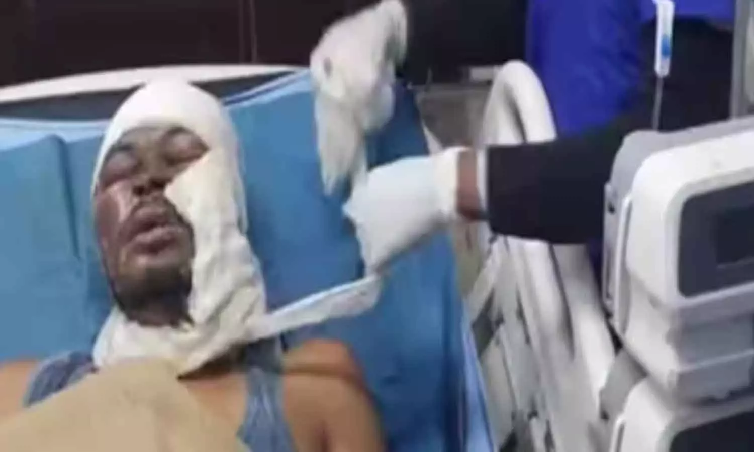 Bihar woman throws acid on man for refusing to marry her