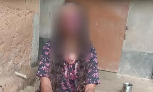 Drunk Karnataka man bites off wife’s eyes, cheeks, hits her with helmet