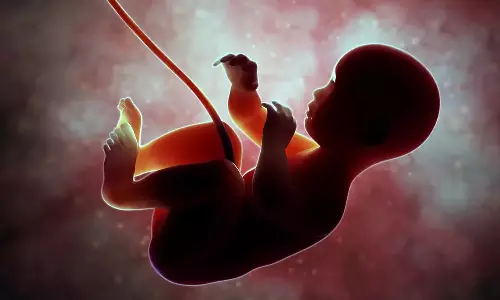 Abdominal Ectopic Pregnancy